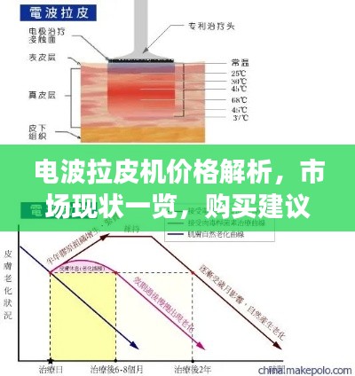 电波拉皮机价格解析，市场现状一览，购买建议助你明智选择